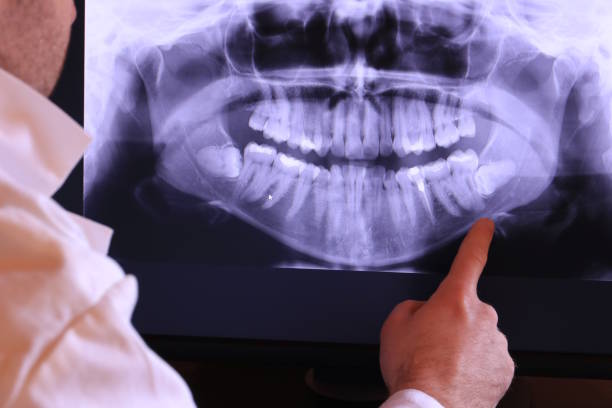 Best Urgent Tooth Repair  in Bayou Blue, LA