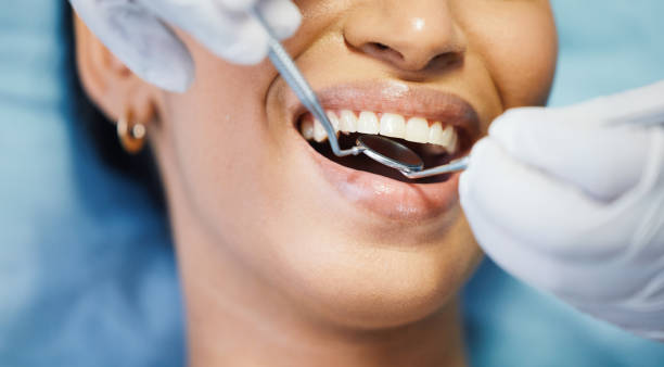 Best Broken Tooth Emergency  in Bayou Blue, LA